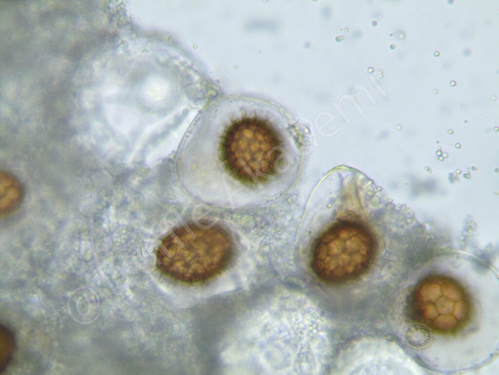Tuber borchii'nin spor ve ascus yapısı,
The spore and ascus structure of Tuber borchii